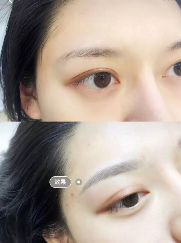 奈思家做出来的的眉毛前后对比 皮肤管理篇 冲着店里的小姐姐们